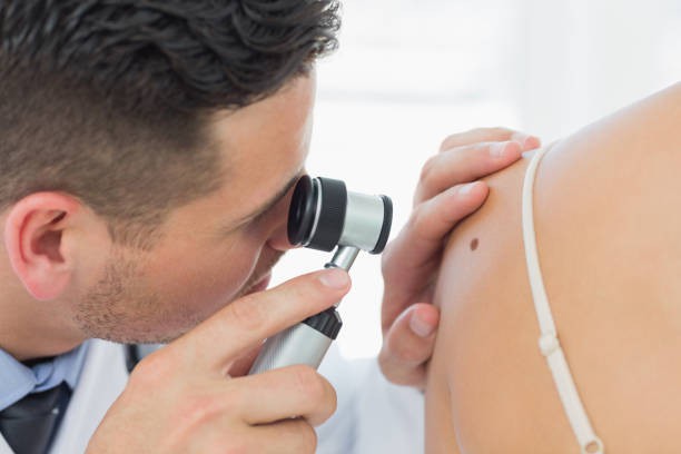 Suntara | Minor Skin Surgery Services